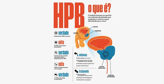 Aumento da Próstata (HPB)